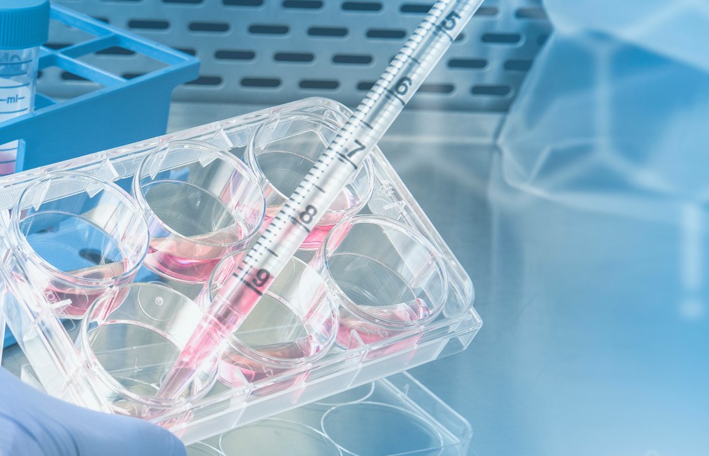 oncologia precision galicia