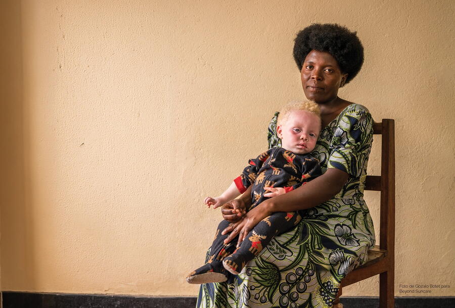 A Sede Afundación de Vigo acolle unha mostra fotográfica da ONG Beyond Suncare sobre o albinismo en África