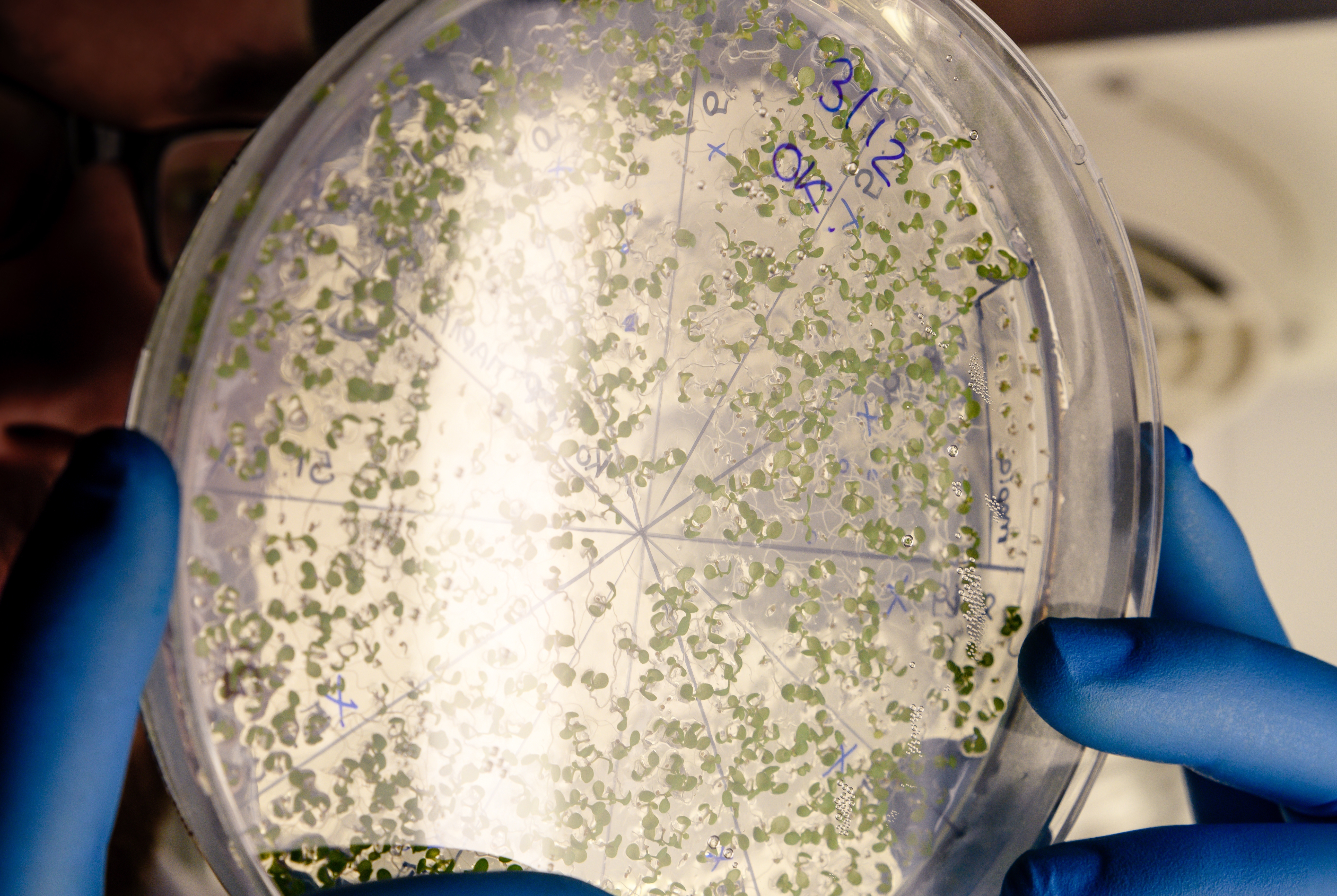 Sanidade, USC y Fundación de Investigación Biomédica Galicia Sur vigilarán la legionelosis
